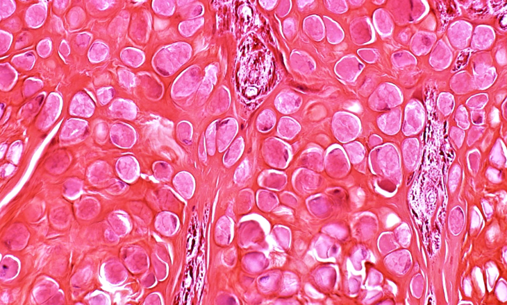 The Palga Foundation’s impact