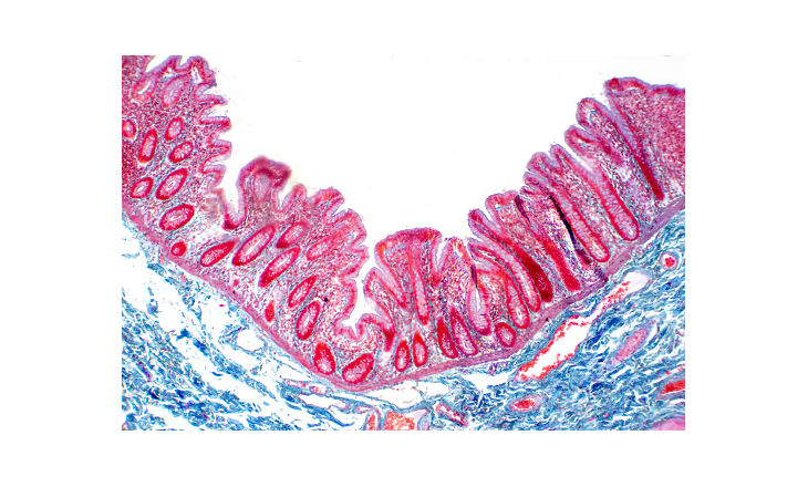 Het bewaren van lichaamsmateriaal door pathologielaboratoria