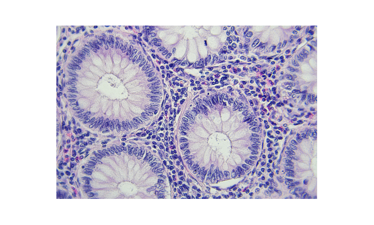 Molecular diagnostics